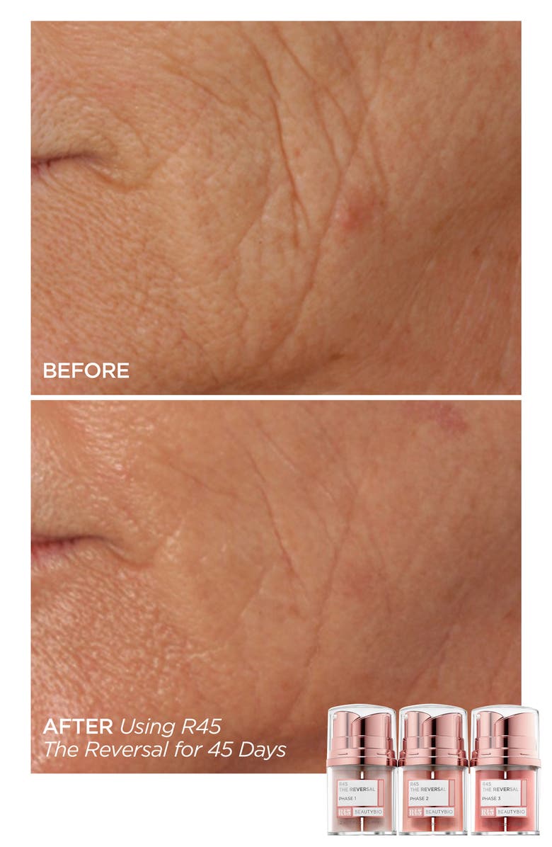 BeautyBio Full Size R45 The Reversal 3-Phase Skin Transforming Treatment Set $235 Value, Alternate, color,