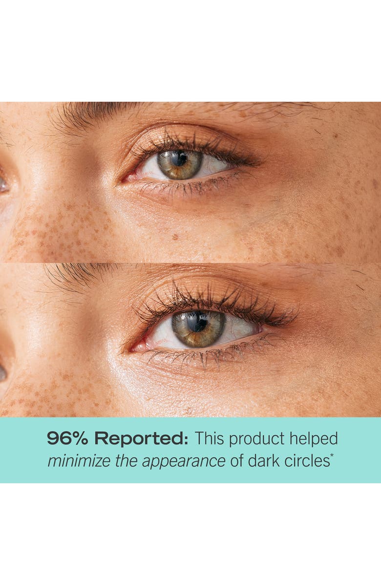 First Aid Beauty Brighten + Glow Eye Cream with Niacinamide, Alternate, color,