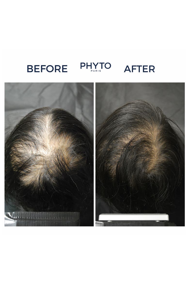 PHYTOCYANE Revitalizing Scalp Serum For Temporary Hair Thinning, Alternate, color, NO COLOR