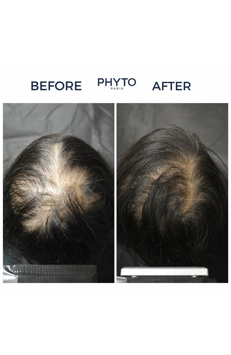 PHYTO CYANE Revitalizing Scalp Serum For Temporary Hair Thinning, Alternate, color,