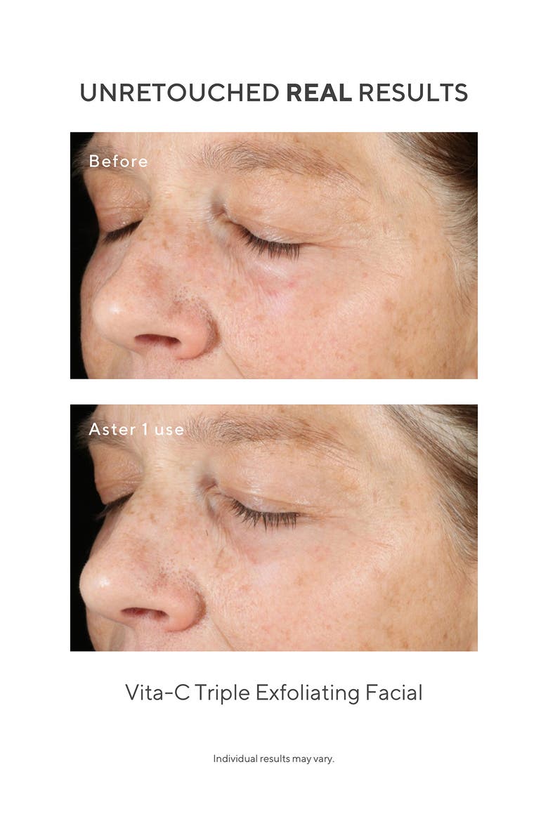 Murad<sup>®</sup> Under the Microscope: The Dark Spot Correctors Set (Limited Edition) $187 Value, Alternate, color, 