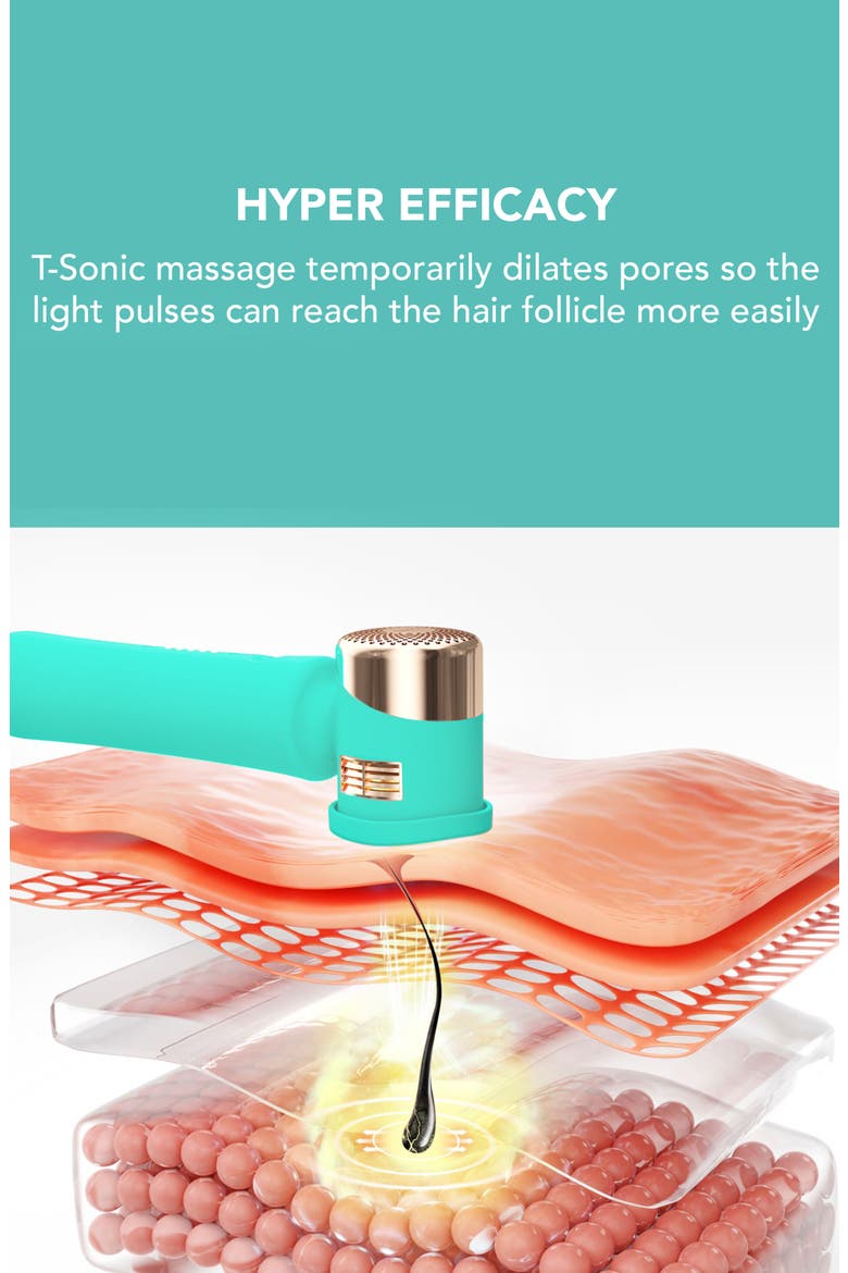 PEACH™ 2 IPL Hair Removal Device, Alternate, color, GREEN