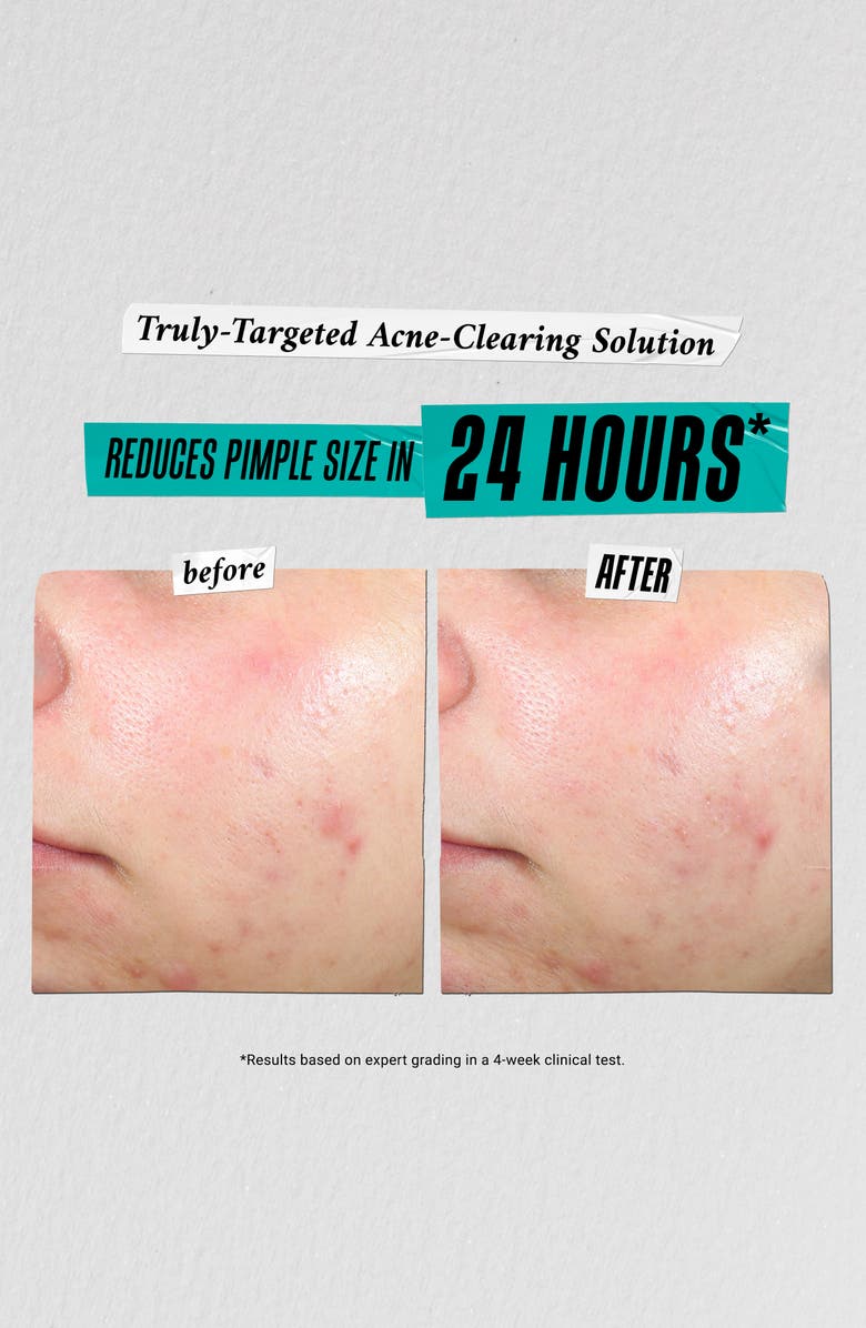 Kiehl's Since 1851 Skin Care Solutions Gift Set $87 Value, Alternate, color,