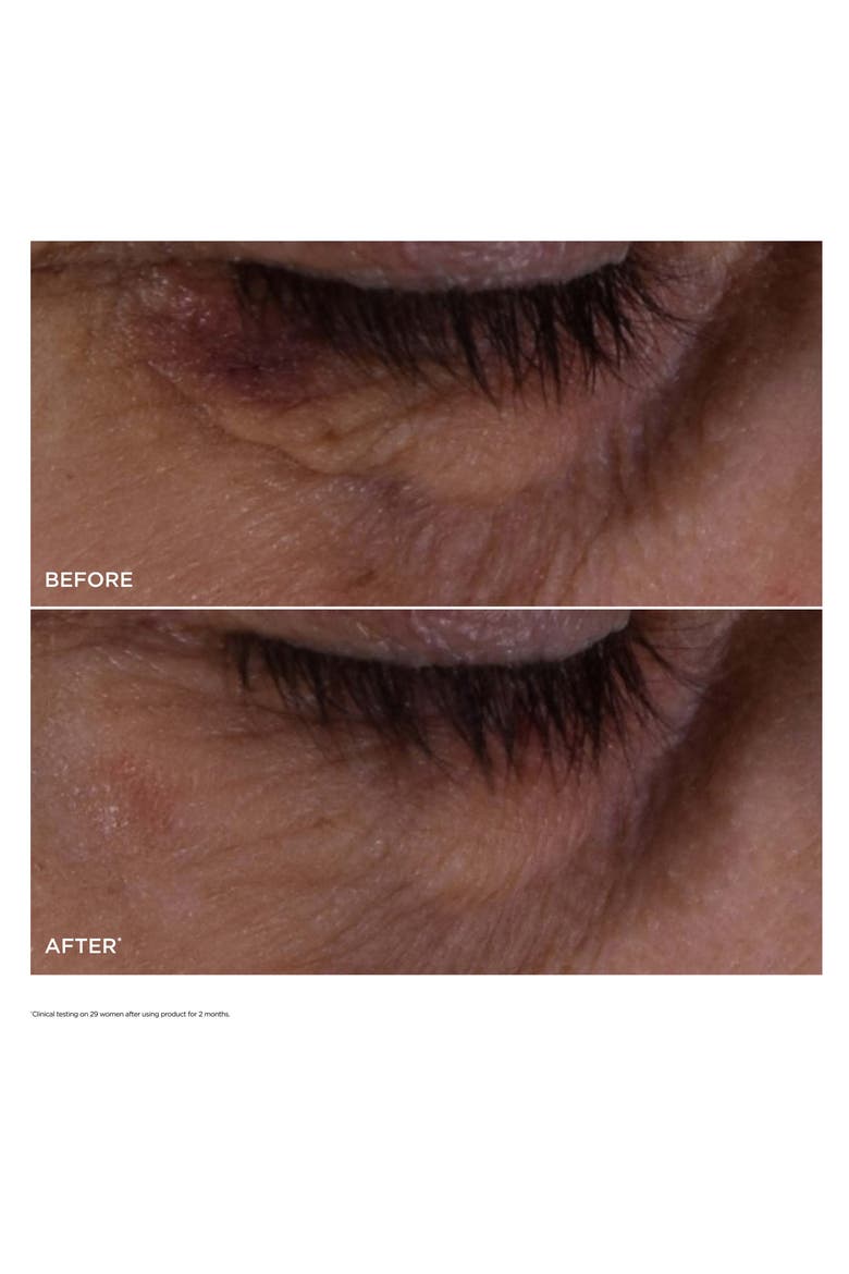 Double Serum® Eye Depuffing Set $134 Value, Alternate, color, NO COLOR