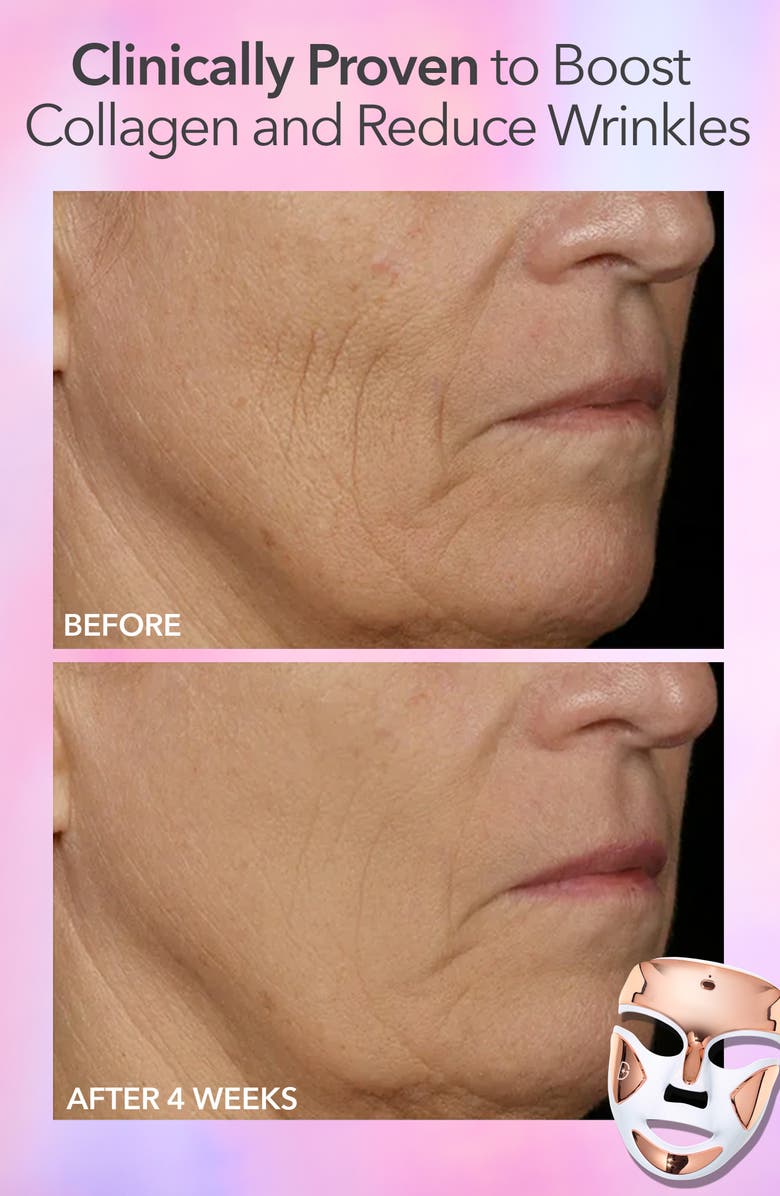 Dr. Dennis Gross Skincare DRx SpectraLite<sup>™</sup> FaceWare Pro LED Light Therapy Device, Alternate, color, 