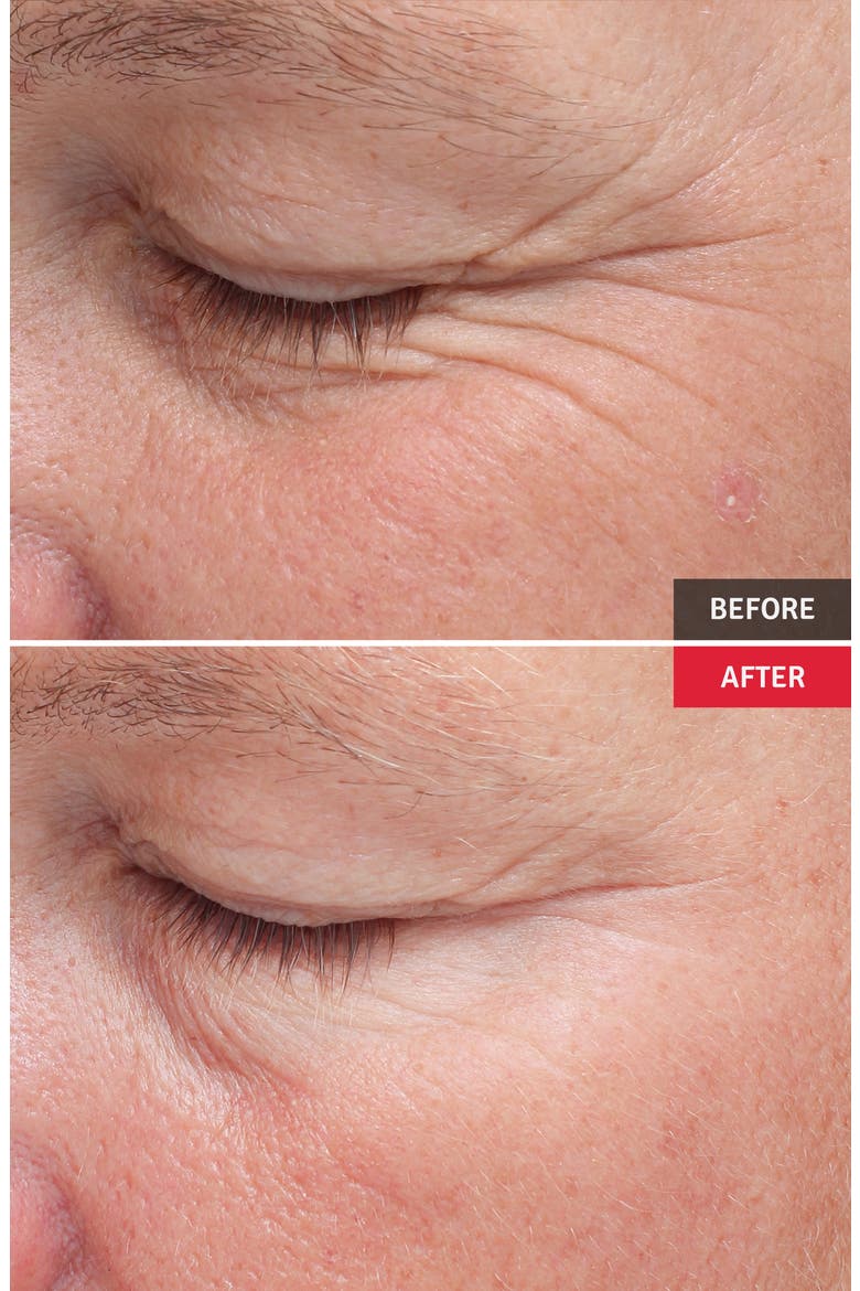 Wrinkle Serum Professional Set, Alternate, color, NO COLOR