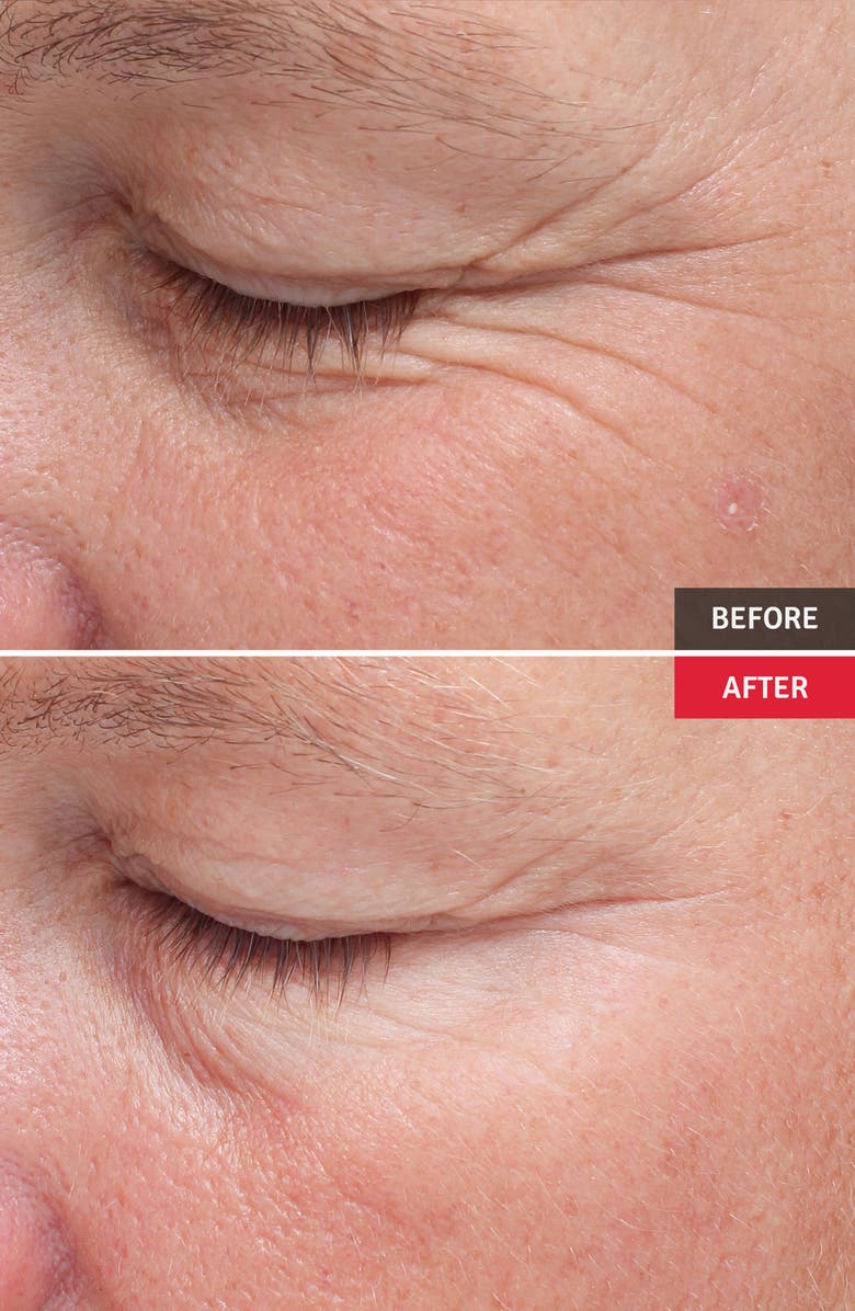 Vitabrid C12 Wrinkle Serum Professional Set, Alternate, color,