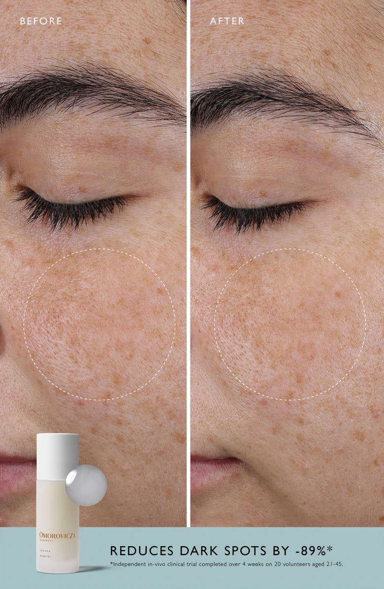 Omorovicza Acid Milk Toner, Alternate, color, 