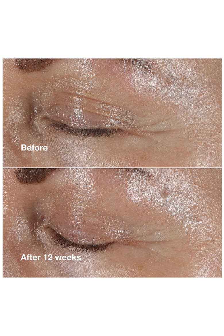 Smart Clinical Repair Wrinkle Correcting Eye Cream, Alternate, color, NO COLOR