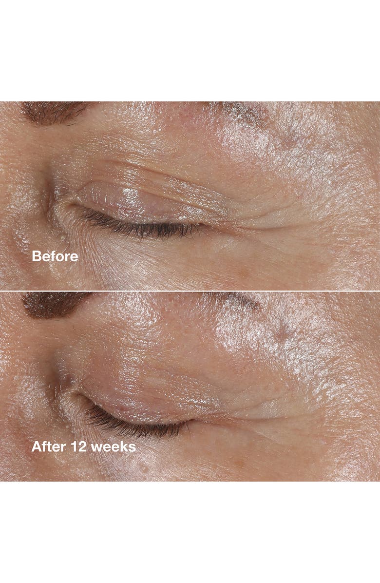 Clinique Smart Clinical Repair Wrinkle Correcting Eye Cream, Alternate, color, 