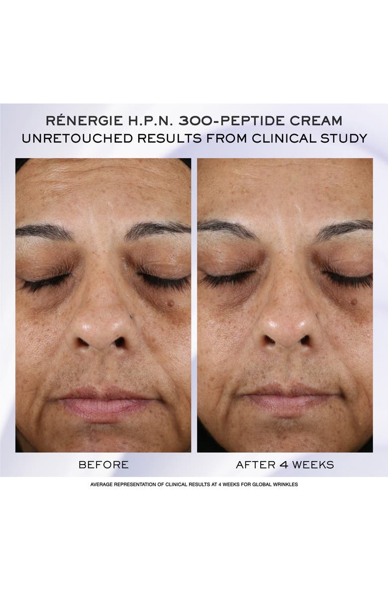 Lancôme Rénergie H.C.F. Triple Serum Skincare Discovery Set $118 Value, Alternate, color, 