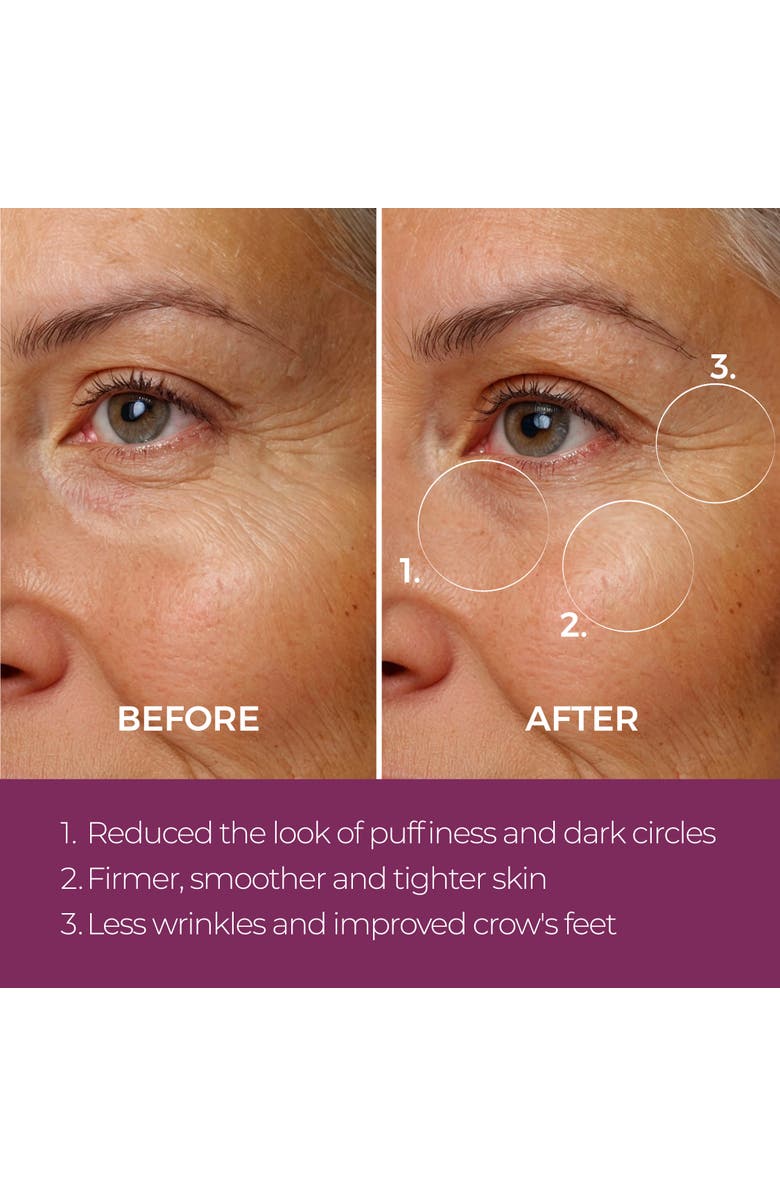 BLINC Eye Repair Peptide Complex, Alternate, color, White