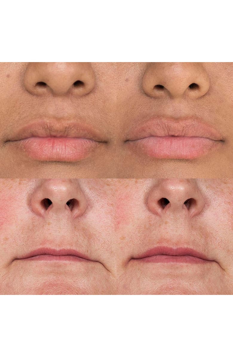 PMD Kiss Lip Plumping System - Berry, Alternate, color,