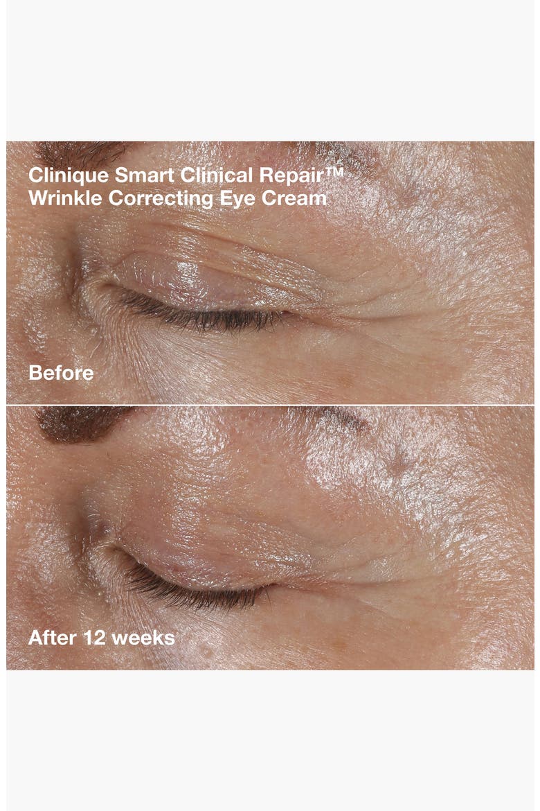 Smart Clinical Repair Duo Set, Alternate, color, NO COLOR