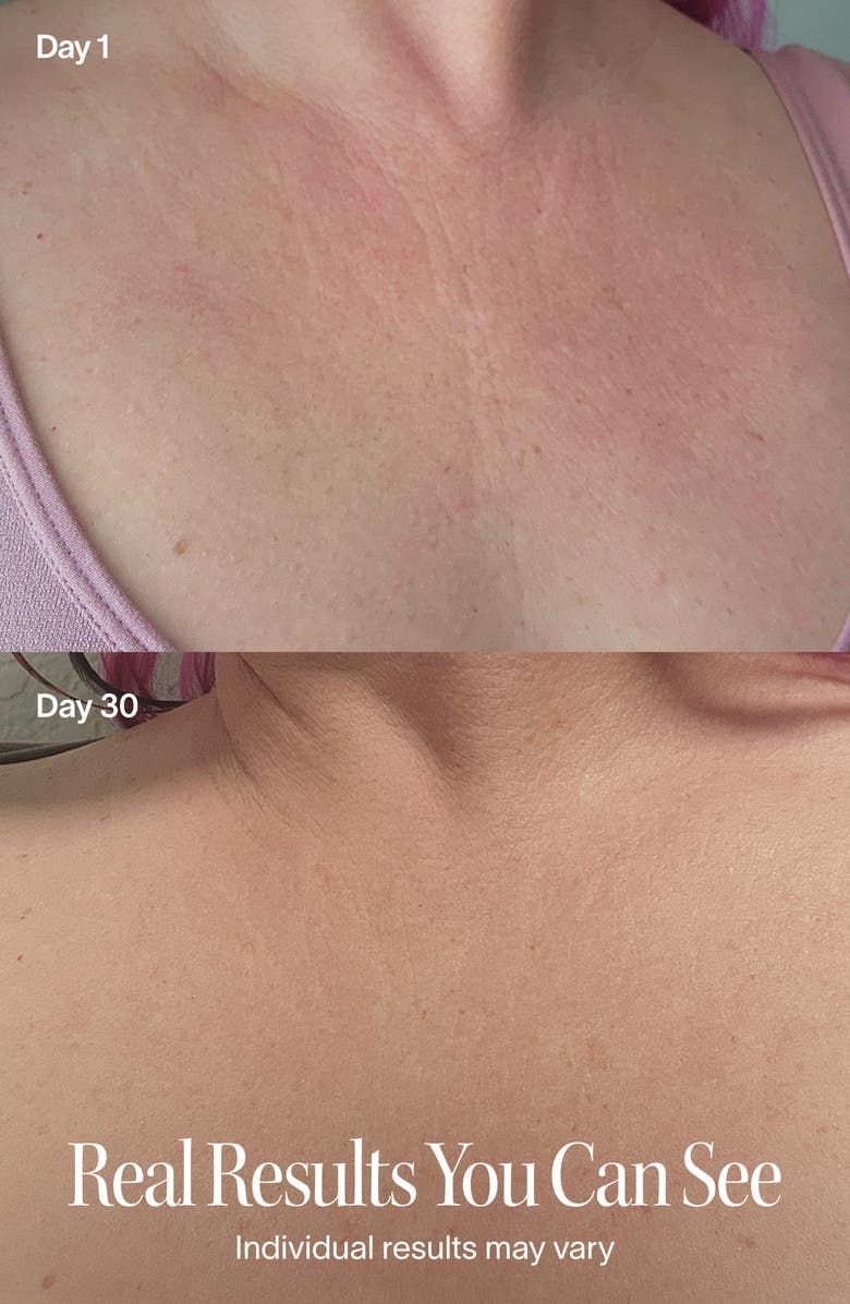 SolaWave Neck & Chest Rejuvenating Red Light Therapy Mask, Alternate, color, Pink