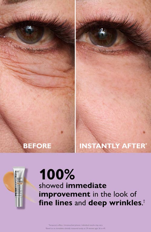 Peter Thomas Roth Instant Firmx Eye Temporary Eye Tightener Easy-wear Formula For Firming Under-eye Bags & Wrinkles 0. In Transparent