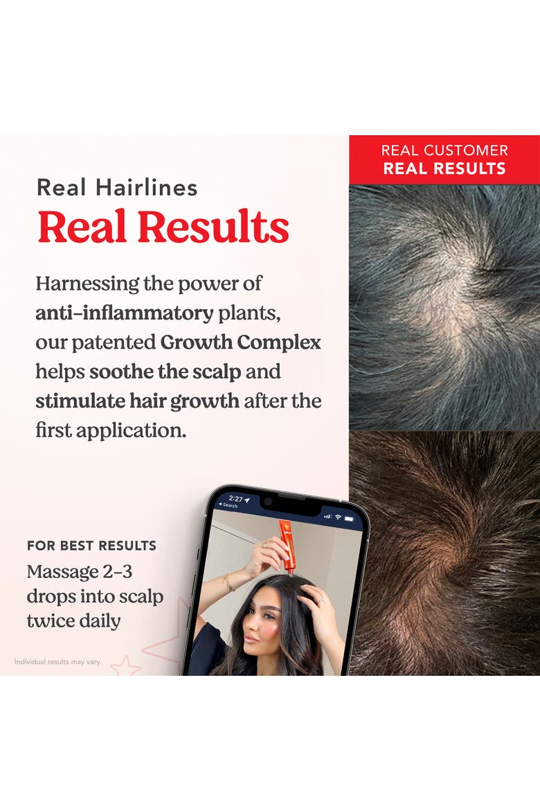 Scalp Serum, Alternate, color, None