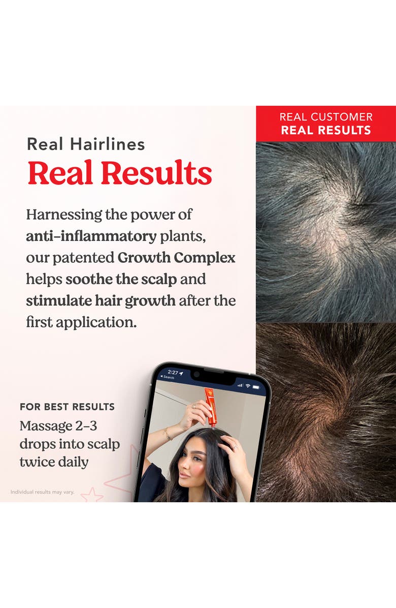 HAIRTAMIN Scalp Serum, Alternate, color, NO COLOR
