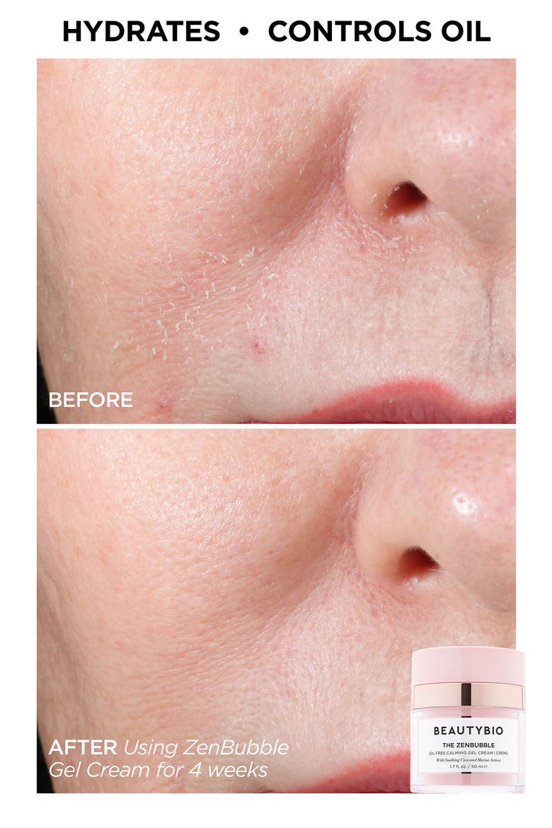Showstopping Skin Set (Limited Edition) $326 Value, Alternate, color, NO COLOR