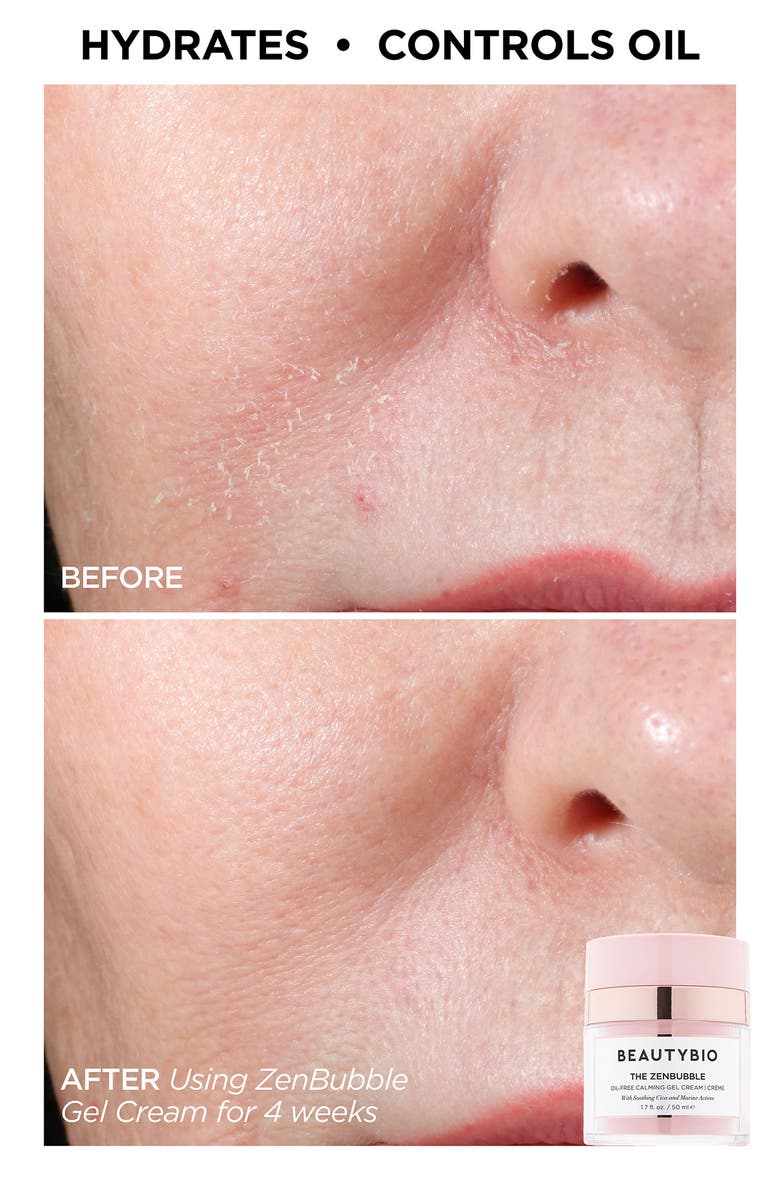 BeautyBio Showstopping Skin Set (Limited Edition) $326 Value, Alternate, color,