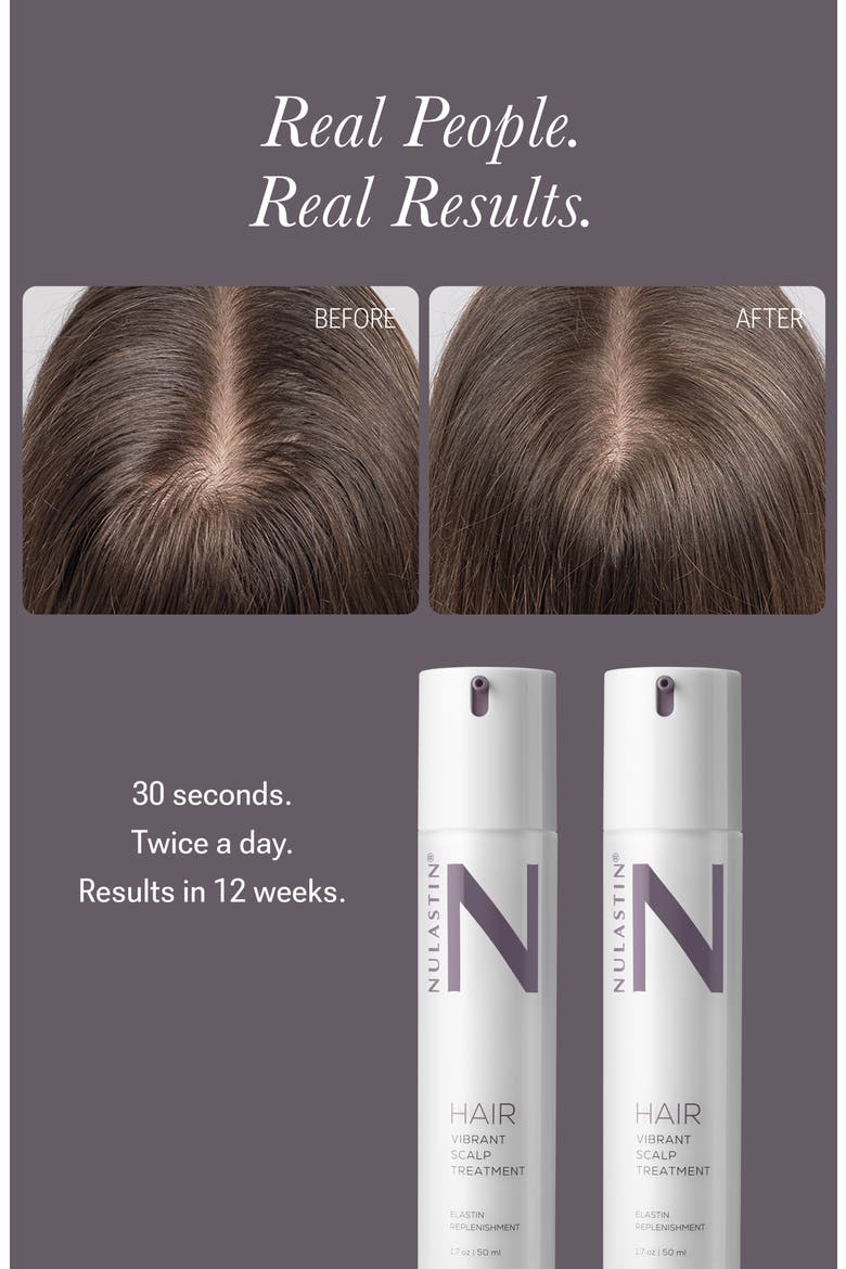 Solution Serum System, Alternate, color, White Brilliant