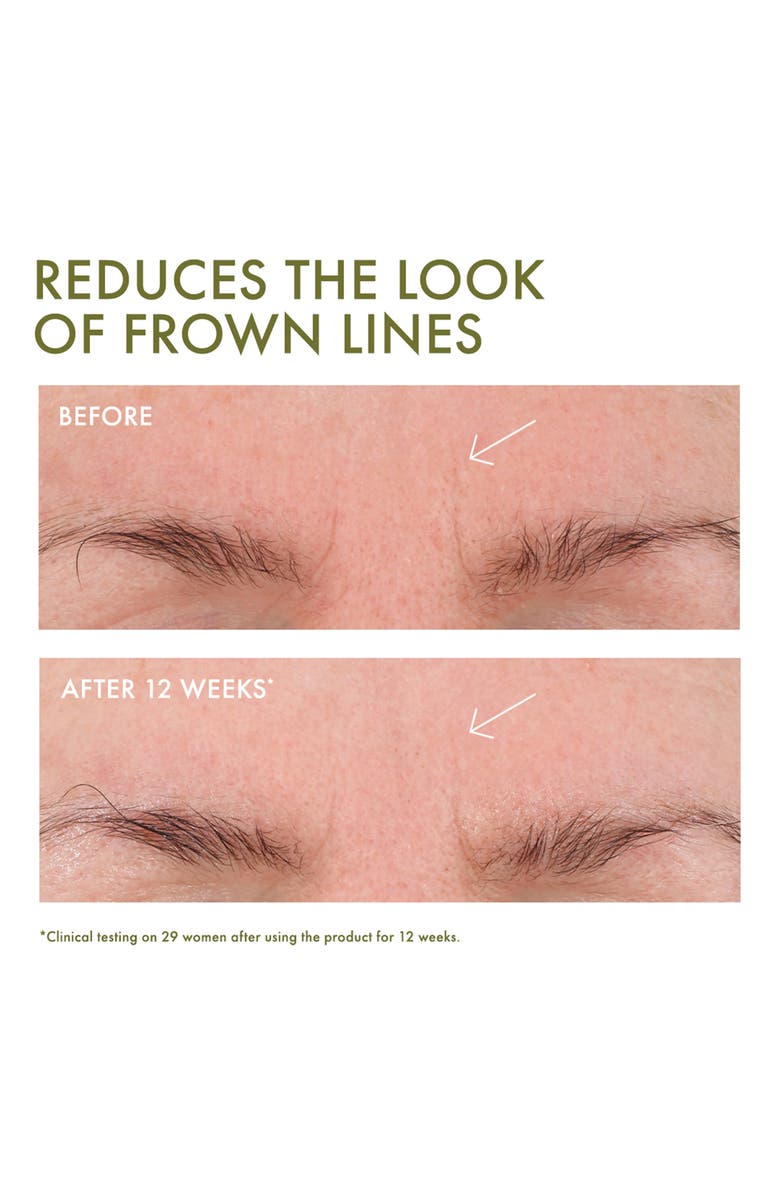 Origins Plantscription<sup>™</sup> Wrinkle Correction Eye Cream with Encapsulated Retinol, Alternate, color,