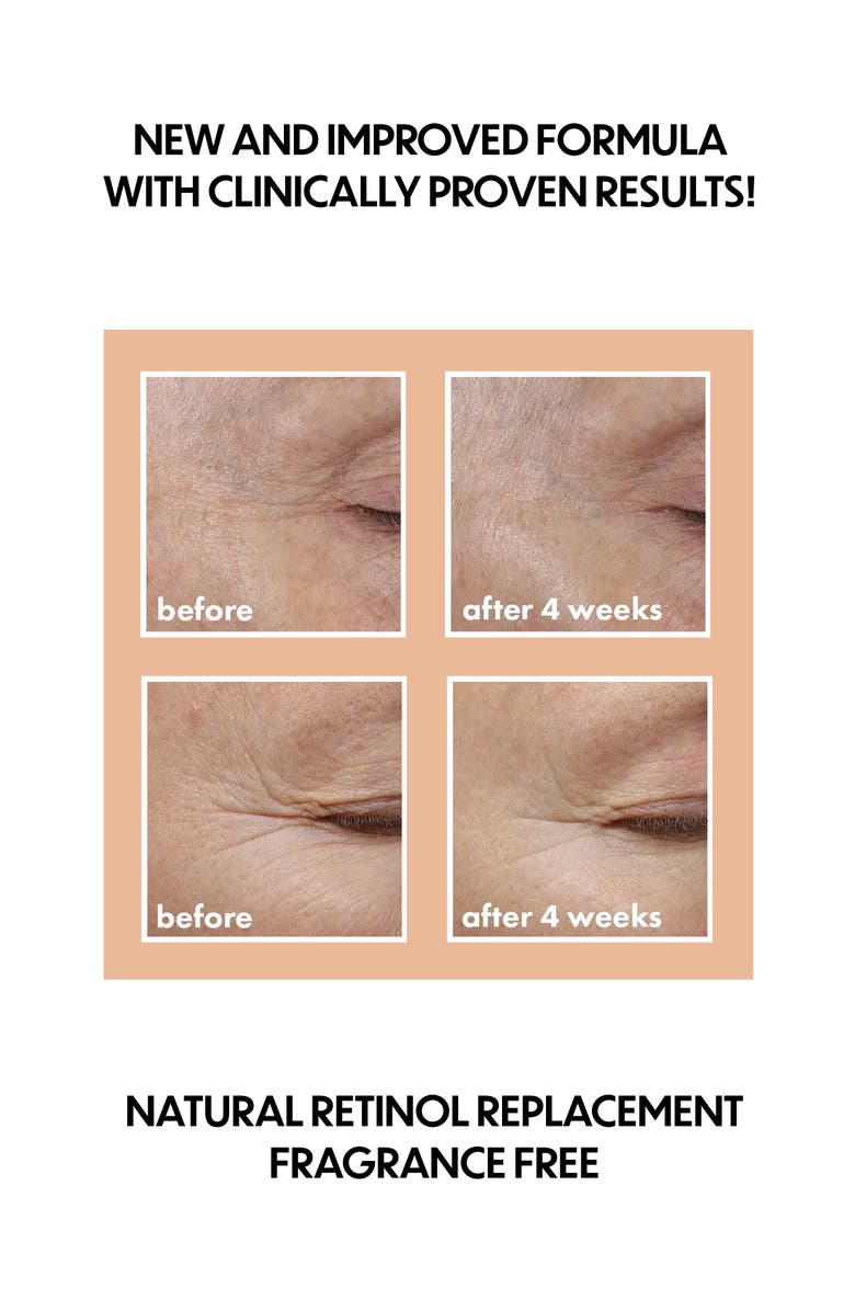 Whish Beauty Revitalizing Eye Cream with Bakuchiol, Alternate, color, 