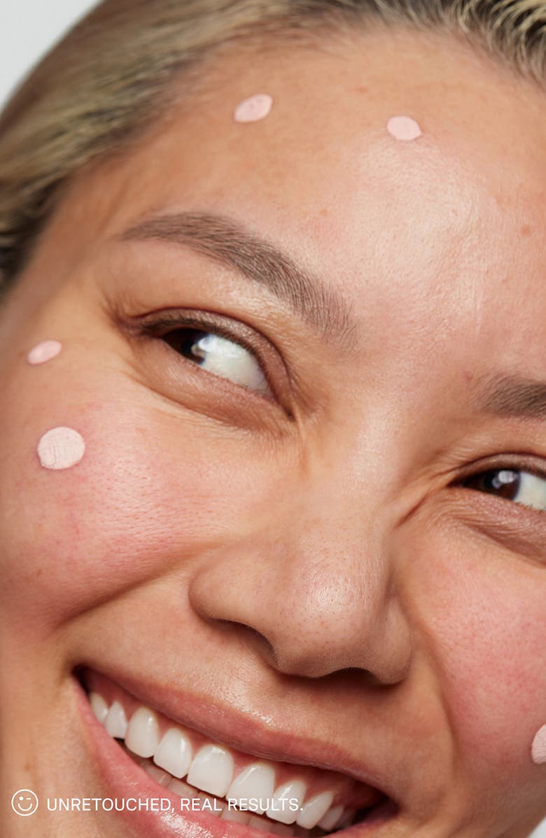 Kate Somerville<sup>®</sup> Breakout Busters Set (Limited Edition) $102 Value, Alternate, color,