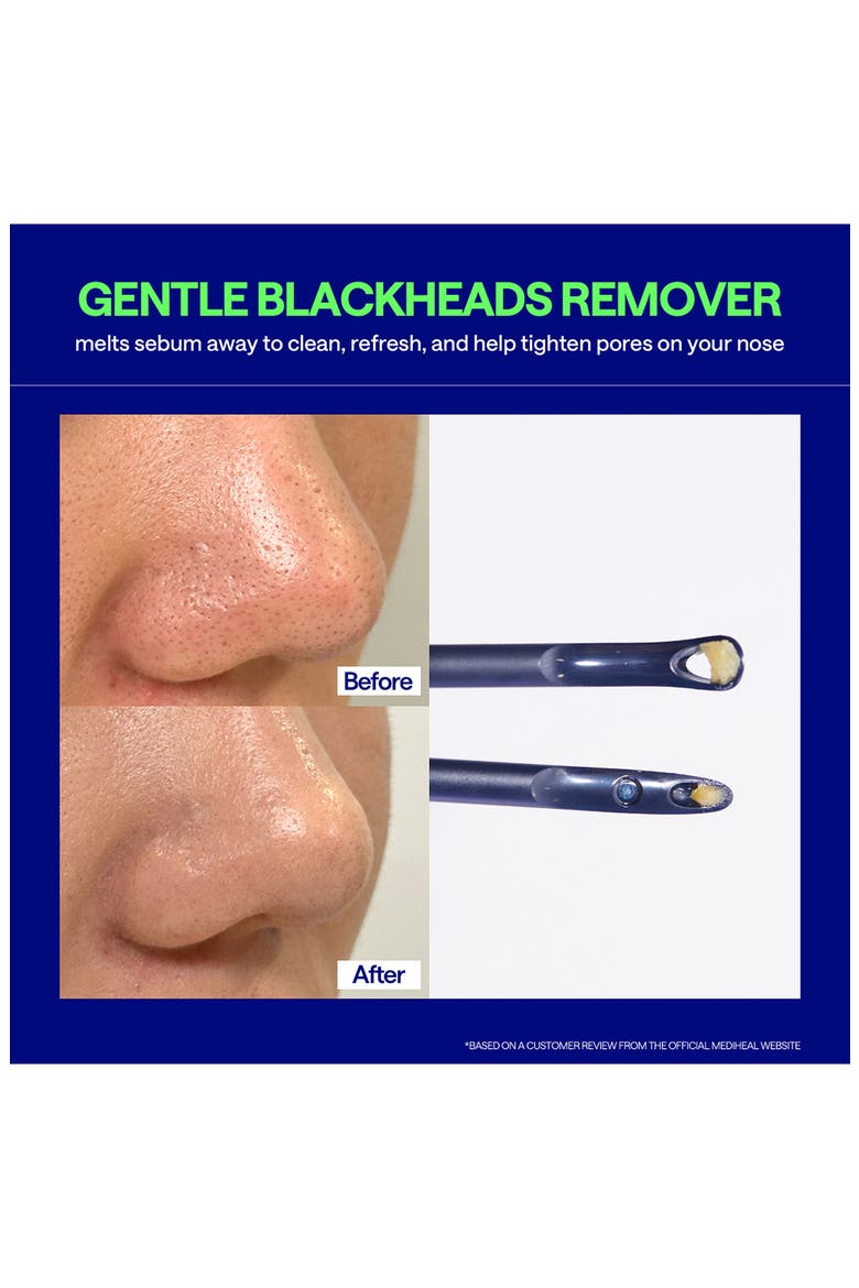 Blackhead Melting Clear Nose Patch, Alternate, color, NAVY