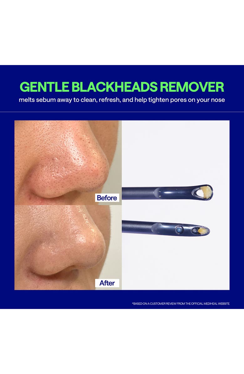 MEDIHEAL Blackhead Melting Clear Nose Patch, Alternate, color, Navy