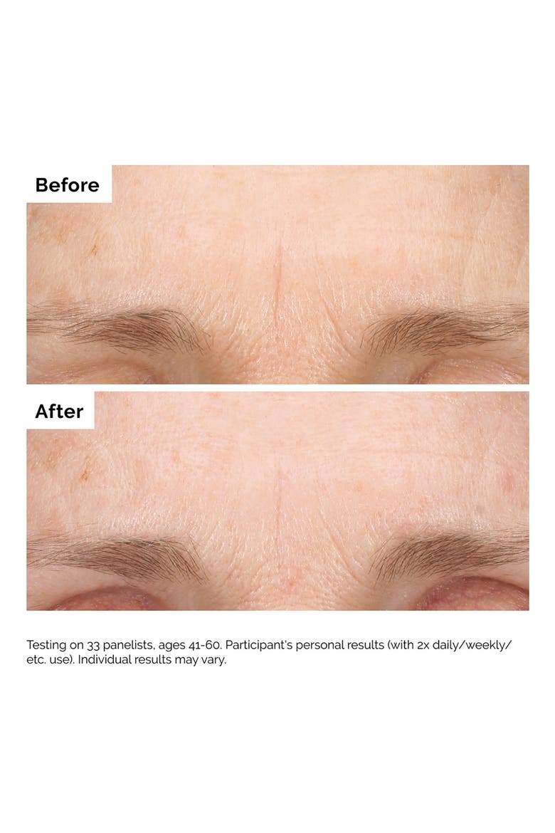 Retinal 0.2% Emulsion High-Strength Retinoid Nighttime Treatment, Alternate, color, NO COLOR