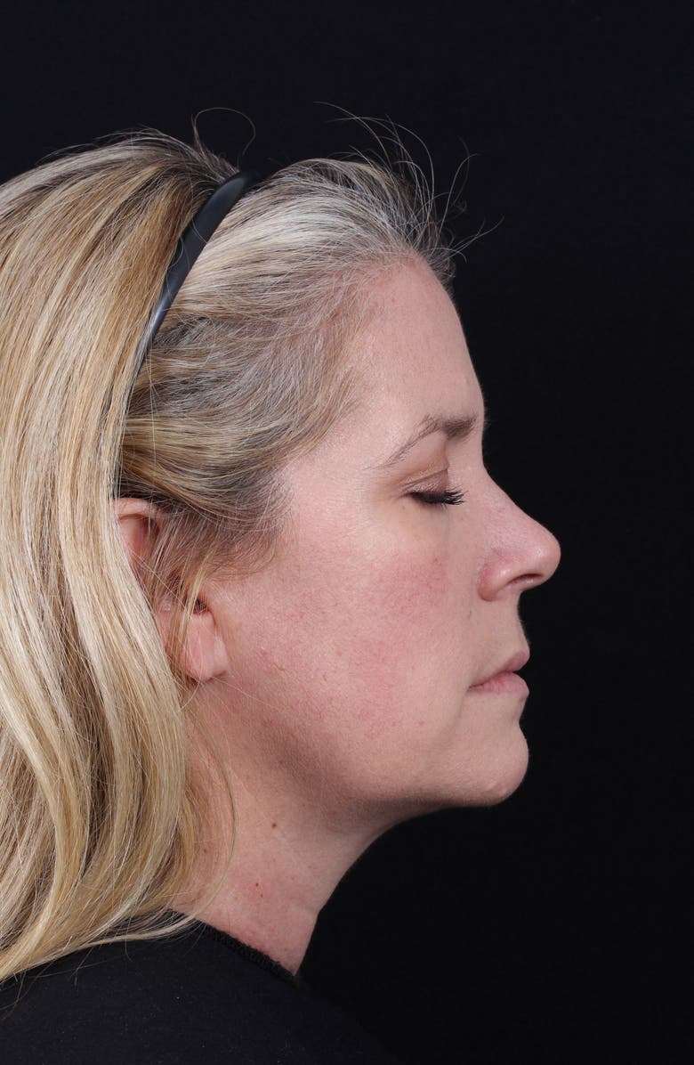 Colorescience <sup>®</sup> All Calm<sup>™</sup> Clinical Redness Corrector SPF 50 PA++++, Alternate, color,