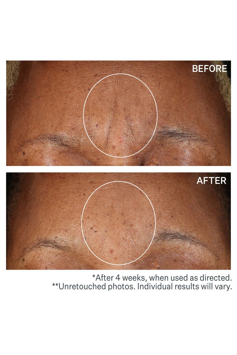 SD™ Advanced Intensive Moisturizing Concentrate for Wrinkles & Stretch Marks, Alternate, color, NO COLOR