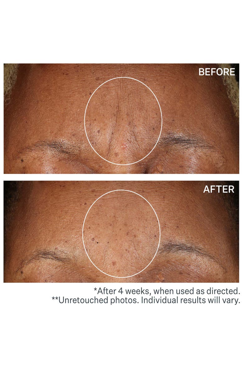 StriVectin<sup>®</sup> SD<sup>™</sup> Advanced Intensive Moisturizing Concentrate for Wrinkles & Stretch Marks, Alternate, color,