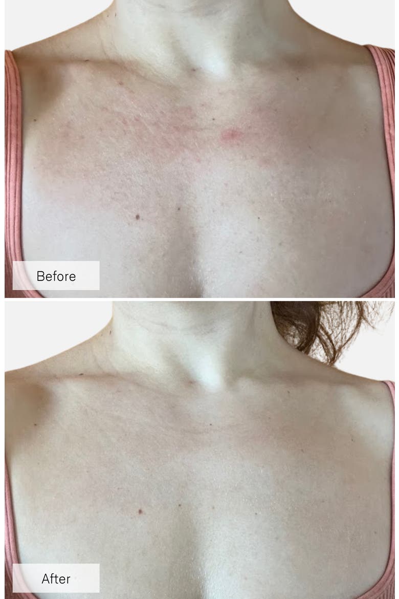 Contour Neck & Décolleté LED Device (Nordstrom Exclusive), Alternate, color, NO COLOR