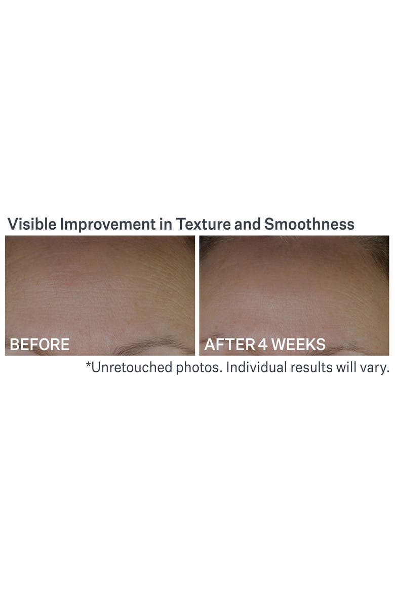 StriVectin<sup>®</sup> Anti-Wrinkle Peptide Plump<sup>™</sup> Line Filling Bounce Serum, Alternate, color,