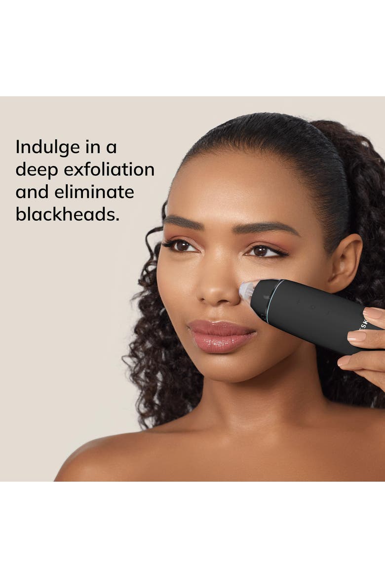 SmartAppGuided MicroDermabrasion Blackhead Remover | 7 in 1, Alternate, color, Gray