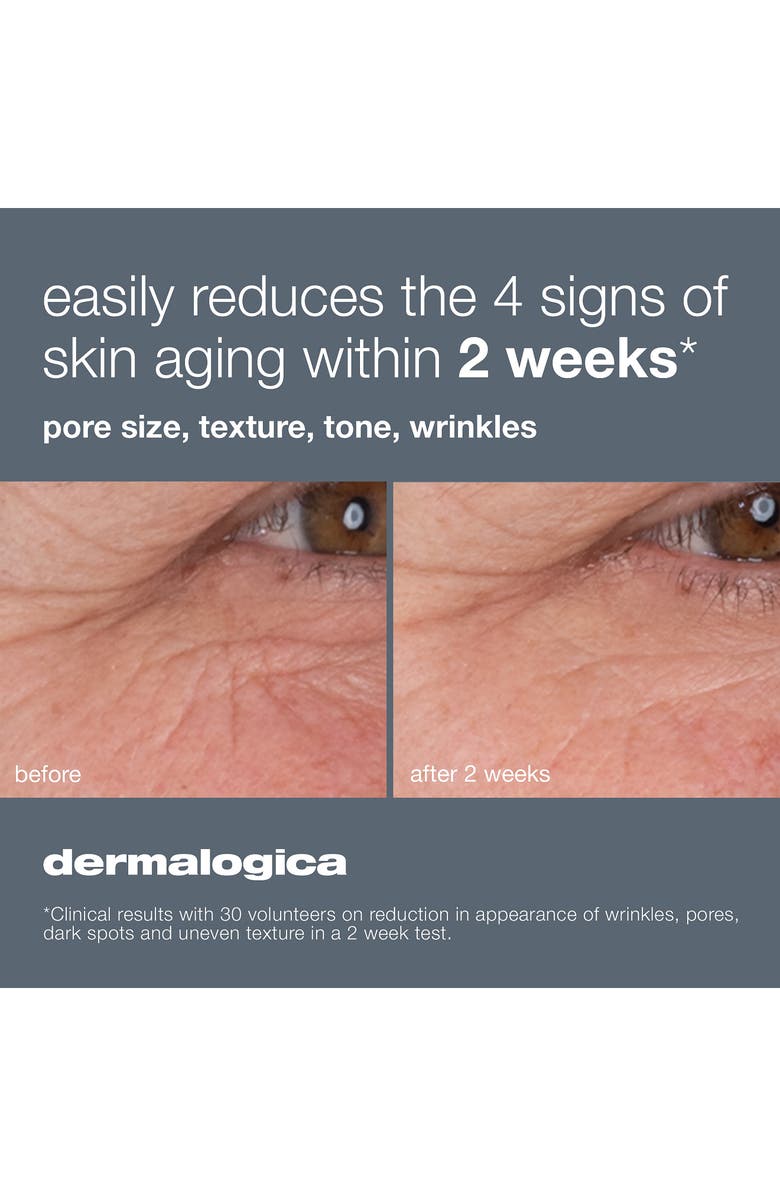dermalogica<sup>®</sup> Dynamic Skin Retinol Renewal Serum, Alternate, color, 