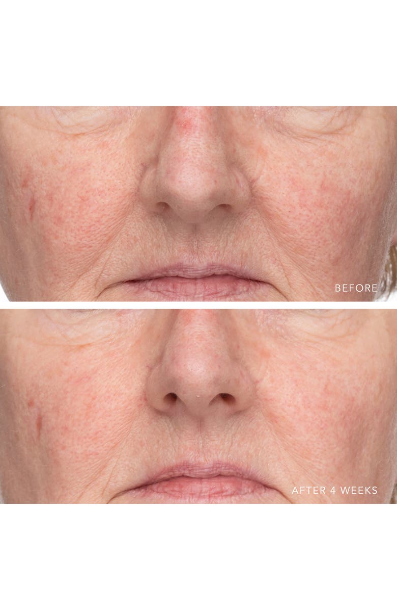 LANCER Skincare Ultra Hydrating Serum with Hyaluronic Complex-7, Alternate, color,