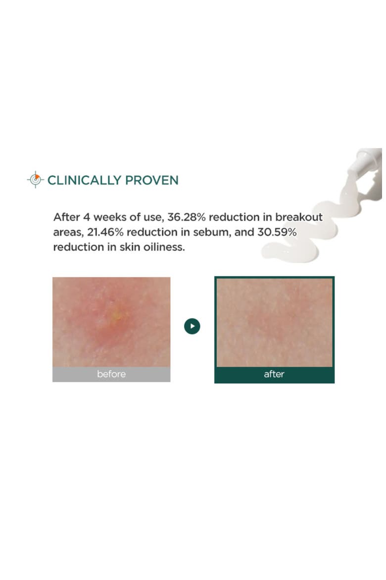 Centella Trouble Spot Serum, Alternate, color, NO COLOR