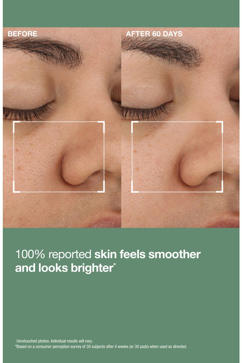 Daily Reveal™ Exfoliating Pads, Alternate, color, NO COLOR