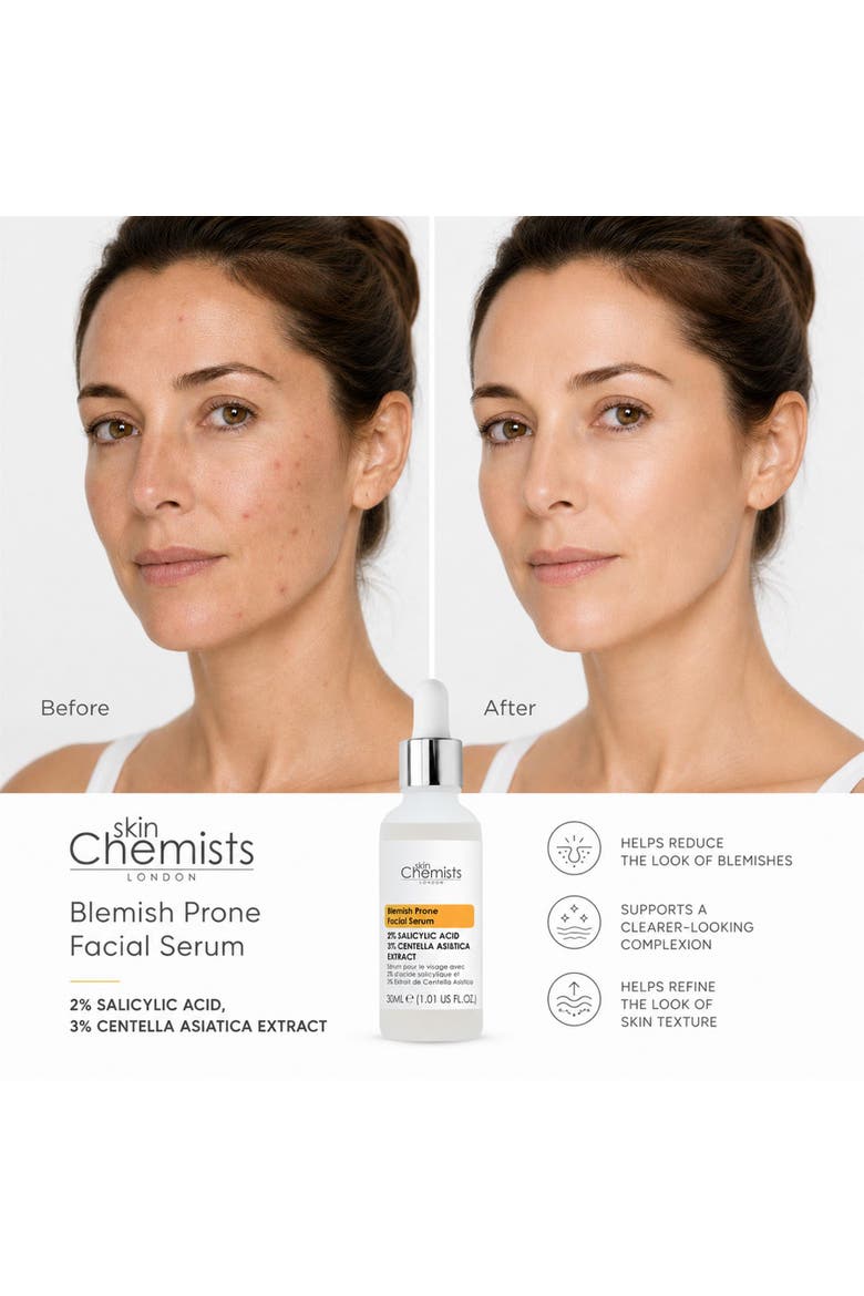 Blemish Prone 2% Salicylic Acid, 3% Centella Asistica Facial Serum 30ml, Alternate, color, White