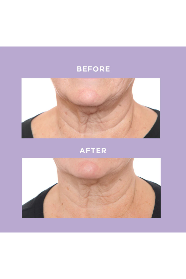 Ageless Throat & Decolletage Creme 50ml, Alternate, color, None