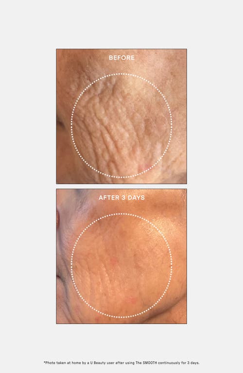 U Beauty The Smooth Dynamic Wrinkle Defense Serum In Transparent