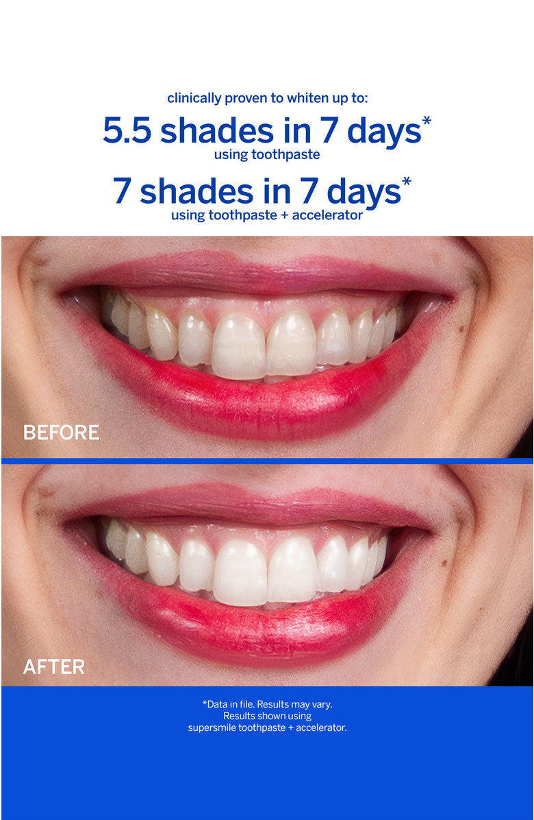 Supersmile Fluoride Free Professional Whitening System - Large, Alternate, color, White