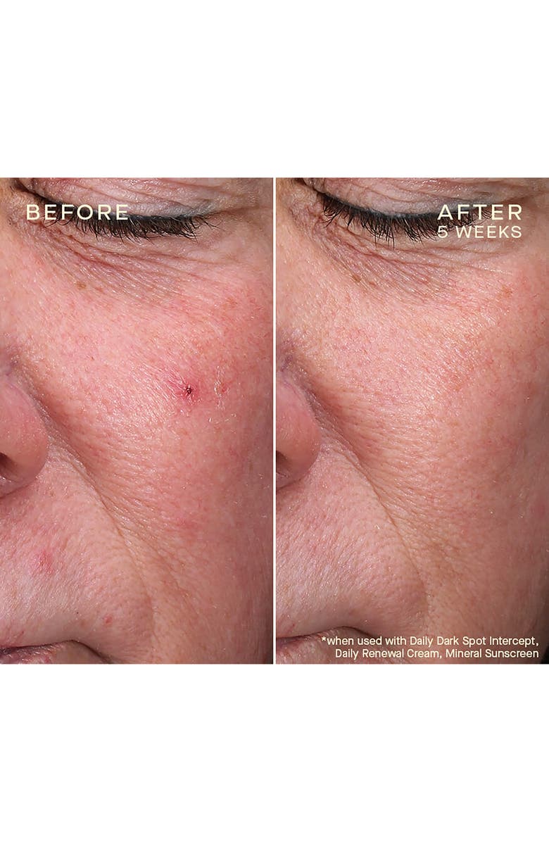 Ourself Dark Spot Intercept, Alternate, color,