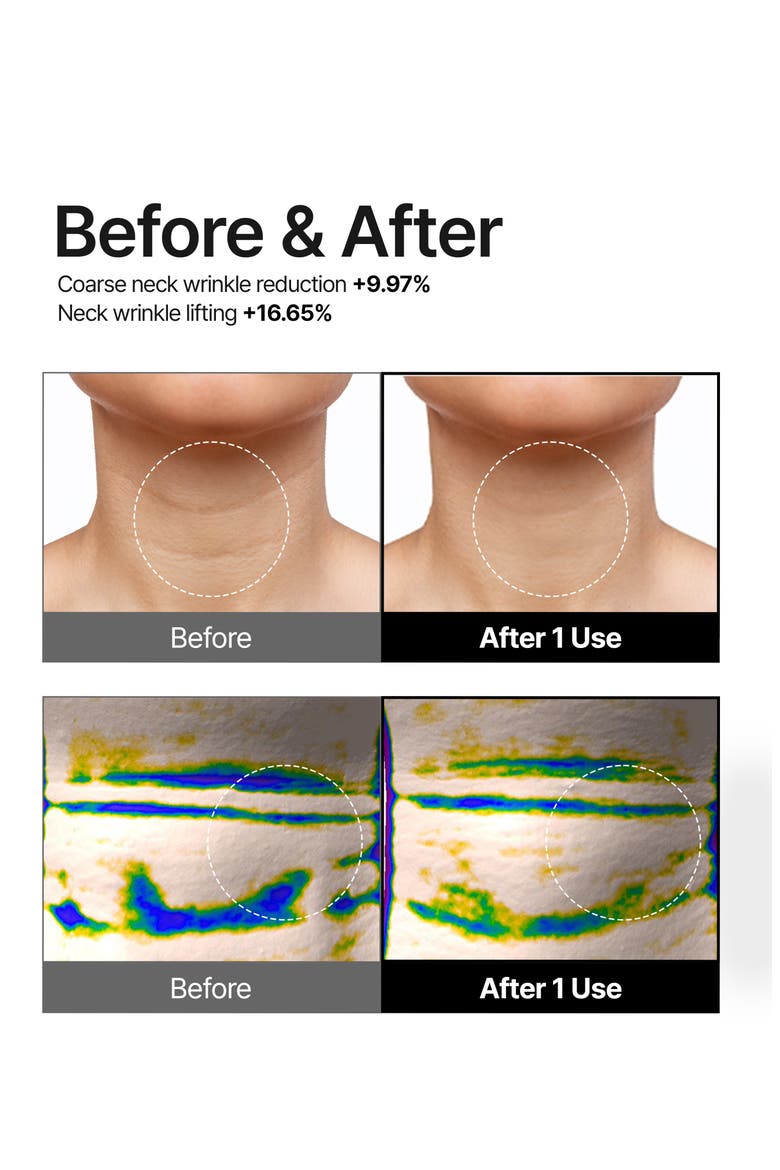 Premium Peptide Naite 1000 Shot Neck Stick 2.0, Alternate, color, NO COLOR