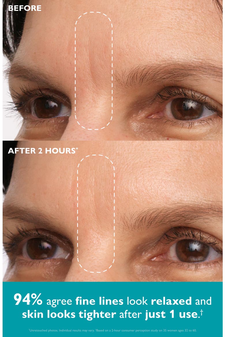 Peptide Skinjection™ Peptide-Infused Face & Eye Tape, Alternate, color, NO COLOR