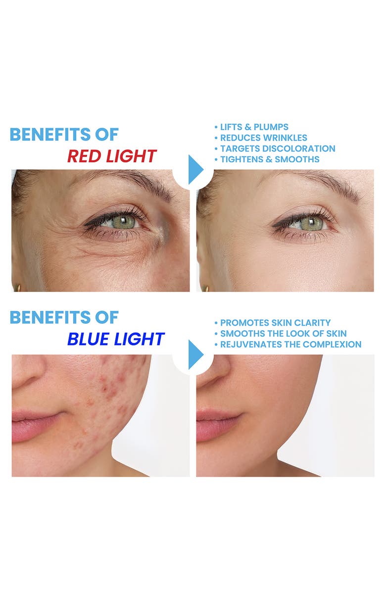 PURE DAILY CARE Luma Mask Professional LED Light Therapy Mask for Face & Neck, Alternate, color,