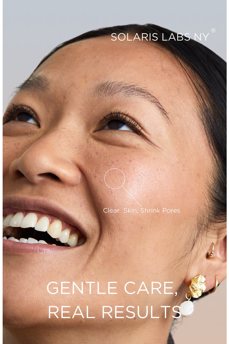 Pore Extractor Device, Alternate, color, NO COLOR